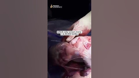 MAGICAL✨The Most RARE Human Birth #birth