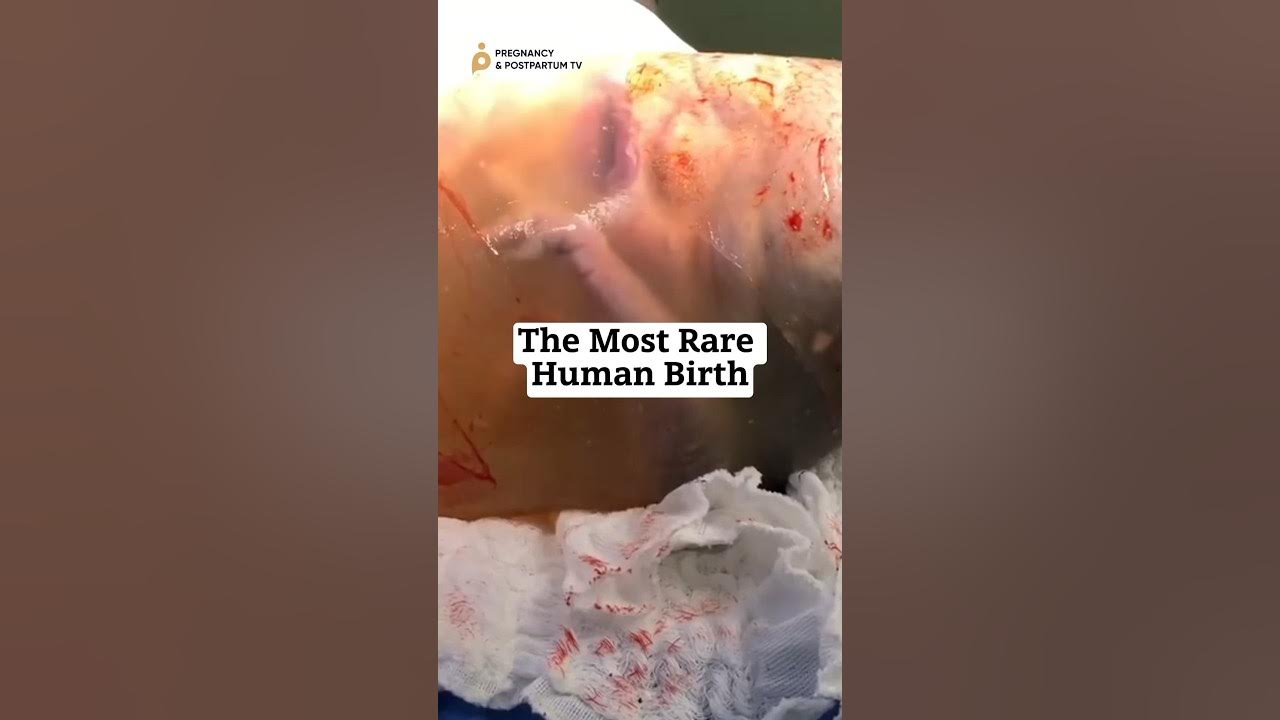 MAGICAL✨The Most RARE Human Birth #birth MAGICAL✨The Most RARE Human Birth #birth