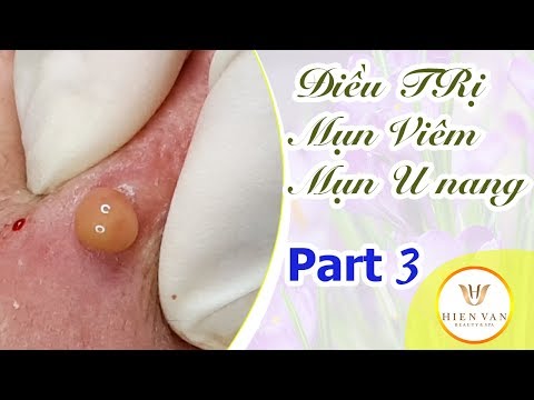 Cách điều trị mụn viêm, u nang, tuổi dậy thì - Hiền Vân spa! Học nghề Spa online - bài 130 (Part 3)