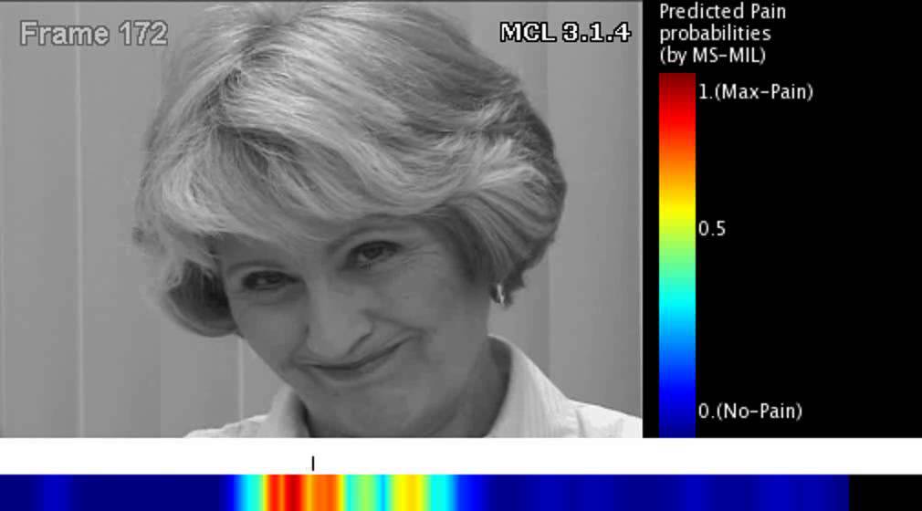 Weakly Supervised Pain Localization- 1