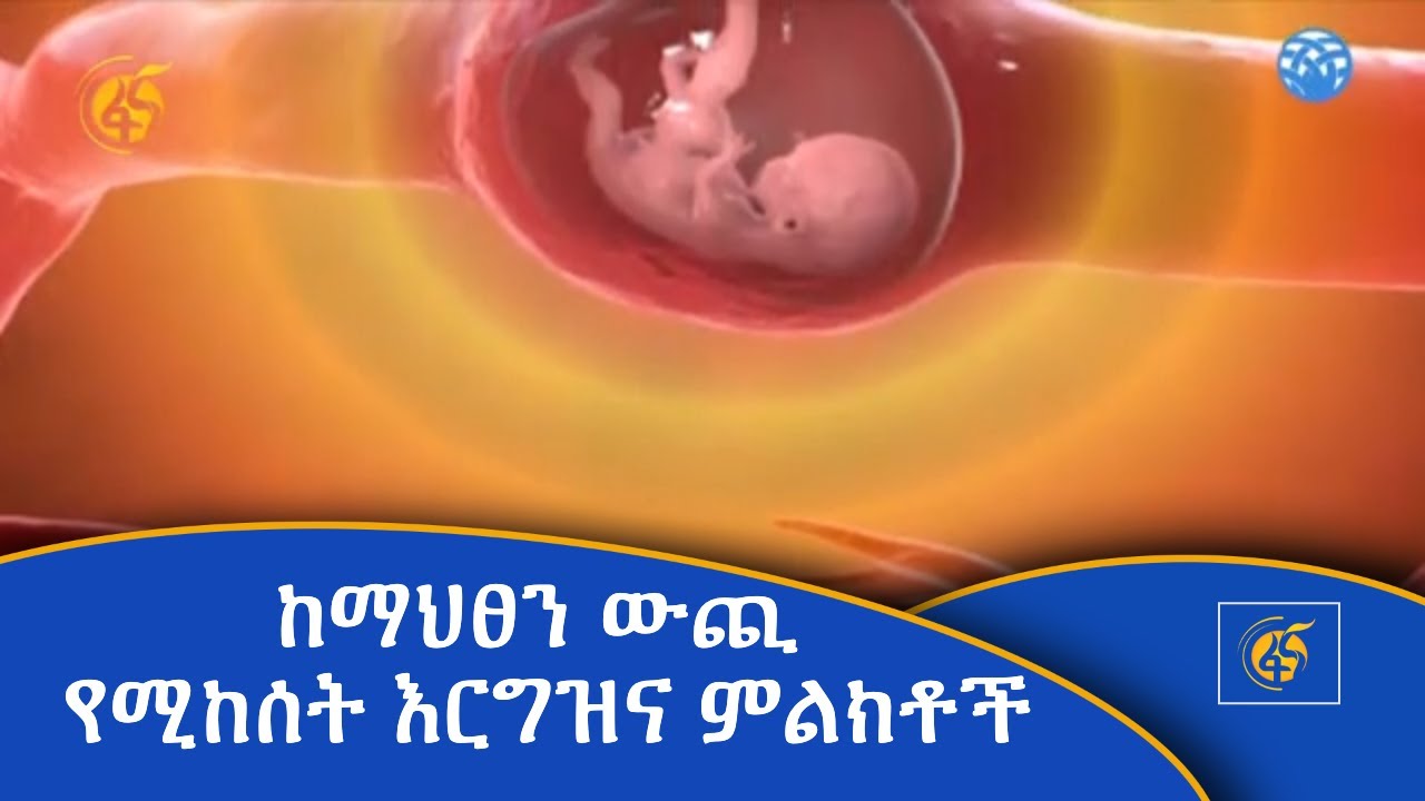 ከማህፀን ውጪ የሚከሰት እርግዝና ምልክቶች