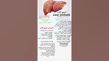 تشمع الكبد Liver Cirrhosis الكبد امراض الكبد اعراض جديد طب مرض السرطان مرضى السكري دم صحة 