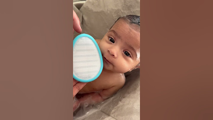 What do you use to treat cradle cap?! Give me all your tips and tricks! ❤️ #cradlecap #babyfrida