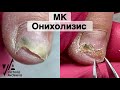 ÐžÐ½Ð¸Ñ…Ð¾Ð»Ð¸Ð·Ð¸Ñ Ð’Ð¸ÐºÑ‚Ð¾Ñ€Ð¸Ñ ÐÐ²Ð´ÐµÐµÐ²Ð°