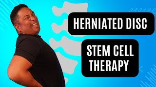 Can I do Stem Cell Therapy For A Herniated Disc?