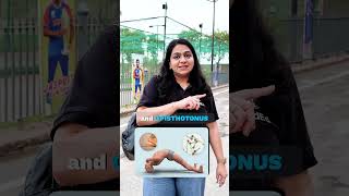 Clostridium Tetani | Drumstick Appearance, Tetanospasmin, Neonatal Tetanus | NEET PG Microbiology