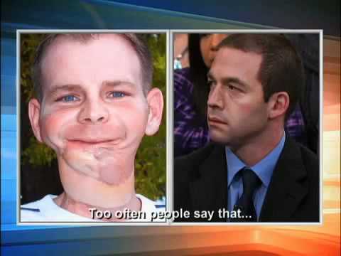 How to Quit Chewing Tobacco on The Doctors-a - YouTube