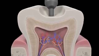 Omnichroma Dental Product Animation