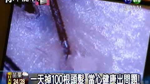 一天掉百髮 健康有問題! - 天天要聞