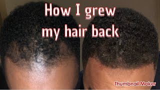 How to grow back receding hairline