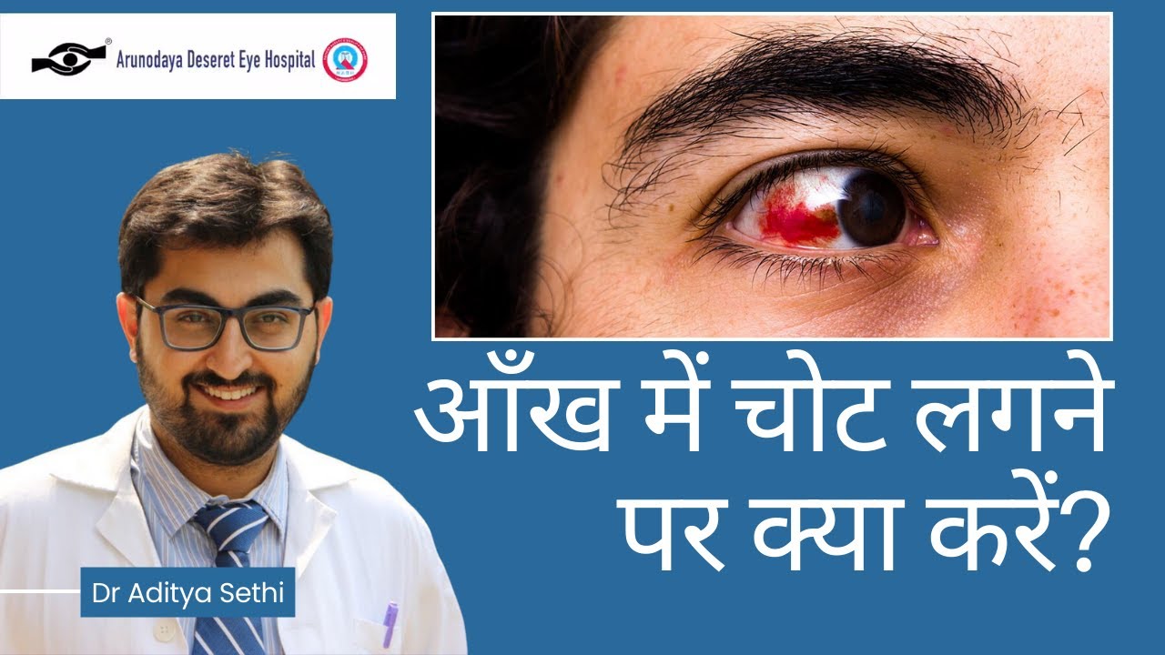 आँख में चोट लगने पर क्या करें? | How to handle an eye injury? | Dr ...