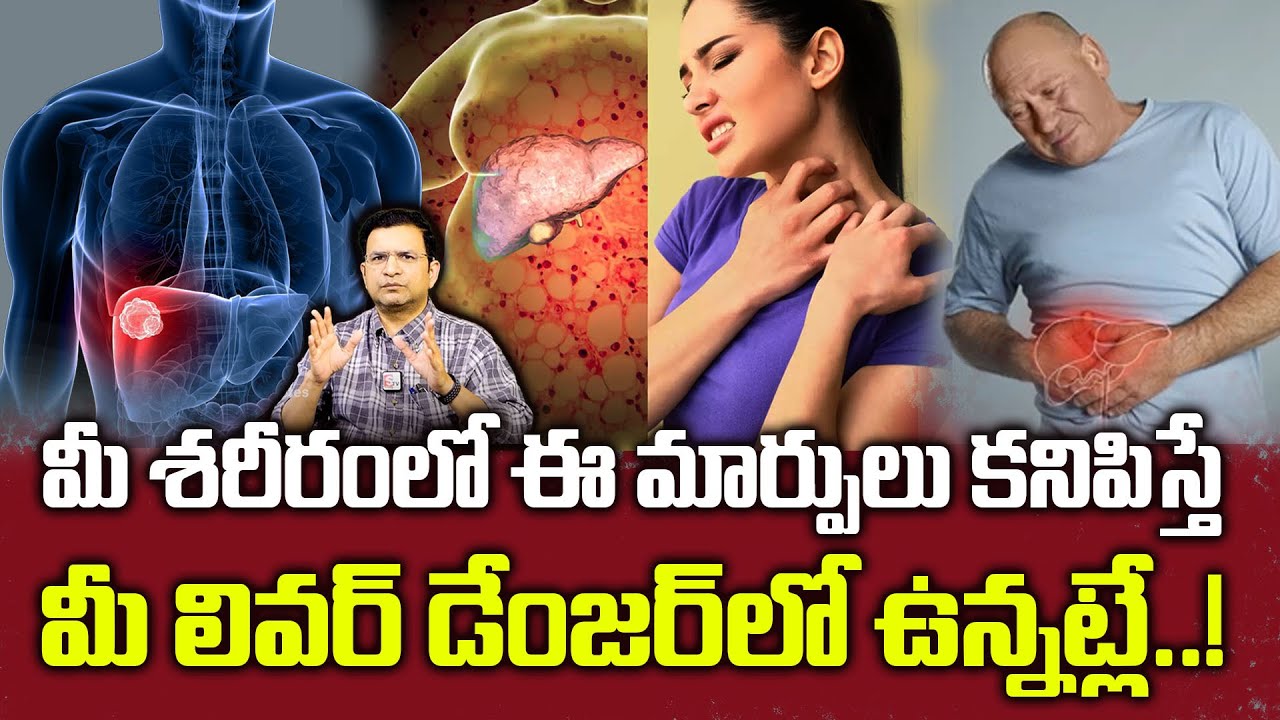 Dr Movva Srinivas : మీ శరీరంలో ఈ మార్పులు కనిపిస్తే మీ లివర్ డేంజర్ లో ఉన్నట్లే..! || Fatty Liver