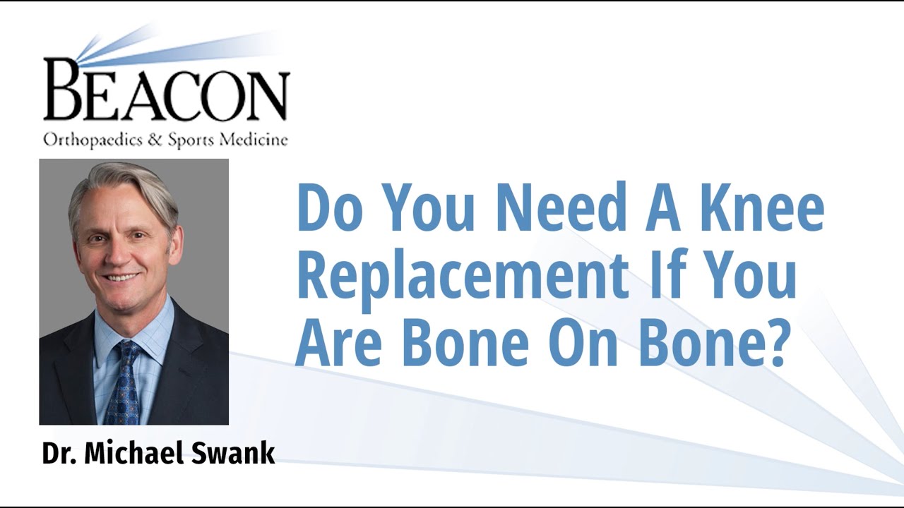 Do You Need a Knee Replacement if You Are Bone on Bone? - YouTube