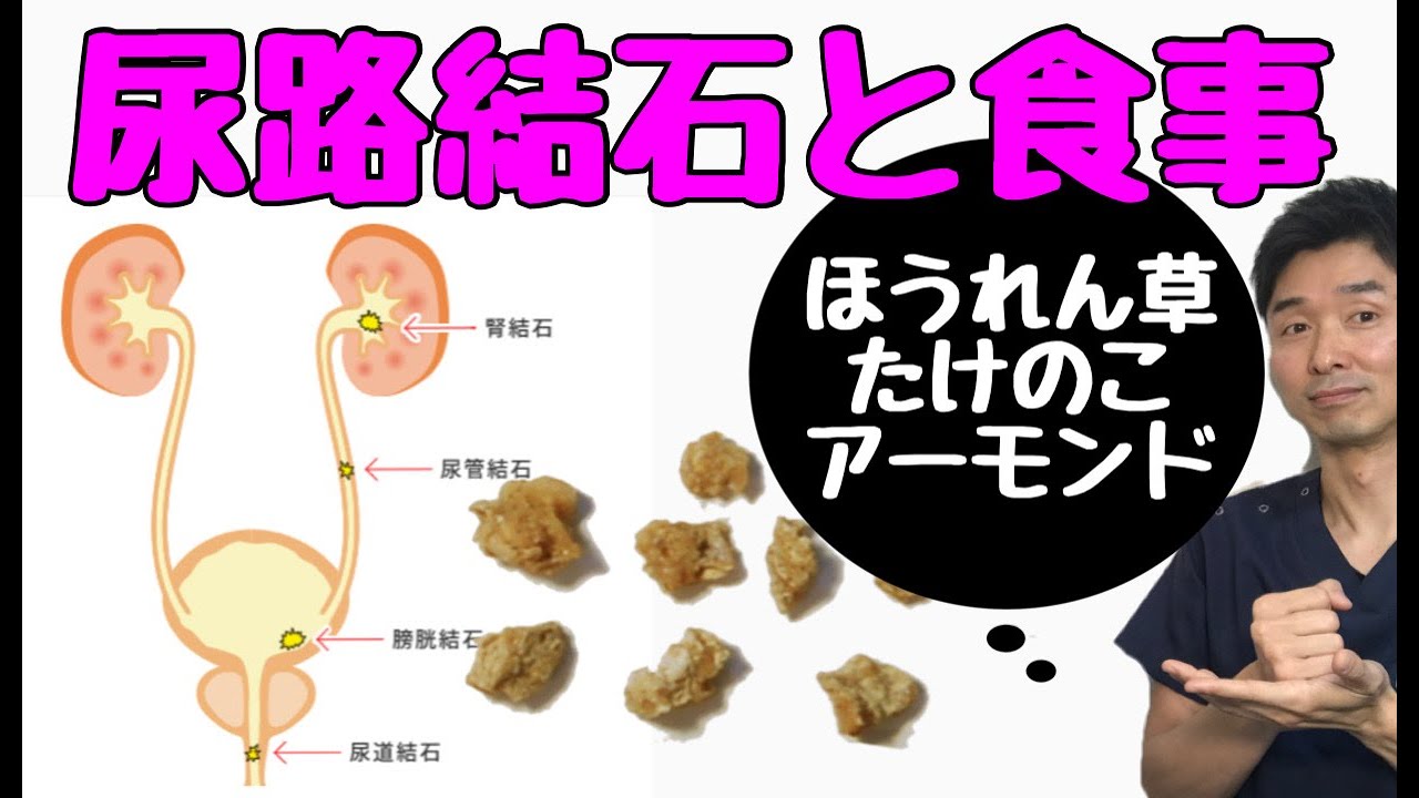 【尿管結石の原因と対策】尿路結石と食事〜結石とほうれん草・たけのこ・アーモンド・ナッツ〜【千葉市の腰痛専門整体院「快」】 - YouTube