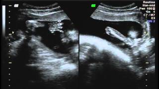 Kennedy Brown Owens Ultrasound 2 Wealth