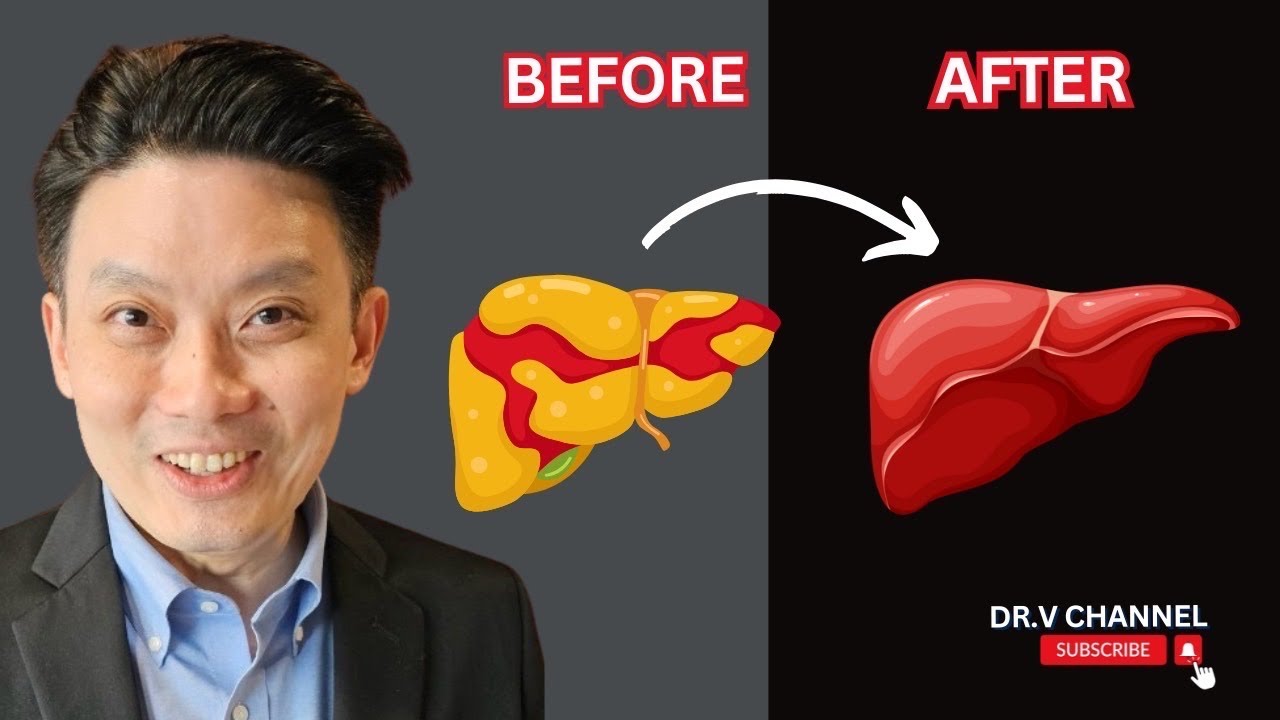 เปลี่ยนตับพัง ให้เป็นตับดี ทำแบบนึ้นะ