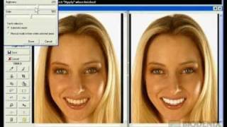 SNAP Cosmetic Dental Imaging - Demonstration Video