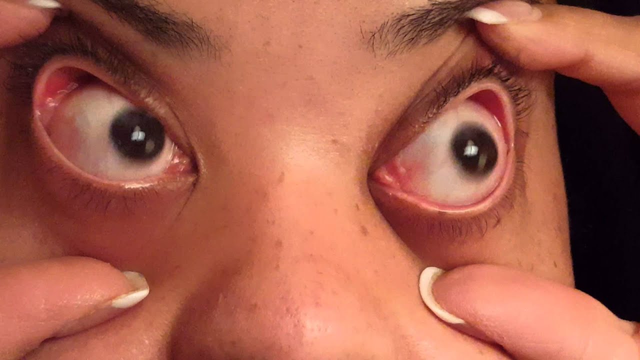 Dancing Eyeballs😊 