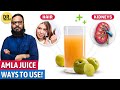 Amla Juice Aapke Jism Ko Phir Jawan Karsakta Hai Amla Juice Benefits Dr Ibrahim Amla Juice Aapke Jism Ko Phir Jawan Karsakta Hai Amla Juice Benefits Dr Ibrahim