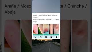 Así identificas insectos según el tipo de picadura. Araña#shorts