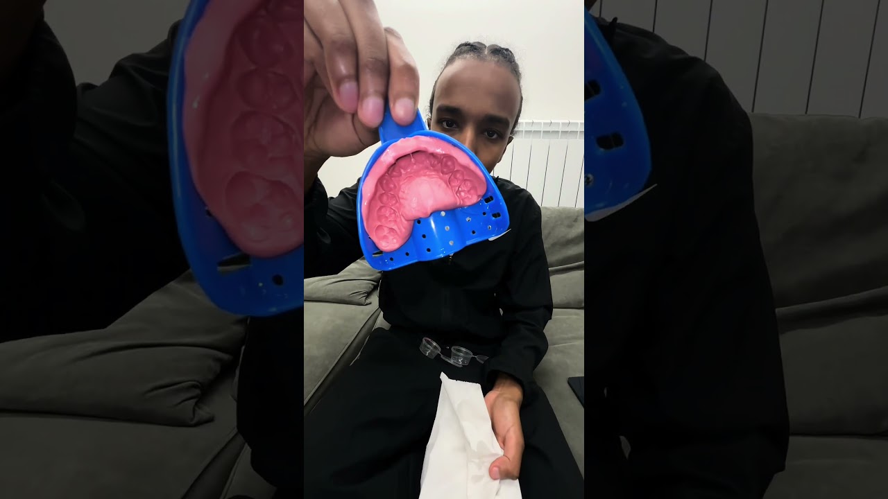 Mould kit instructions (we no longer use the syringes in the second part of the video)