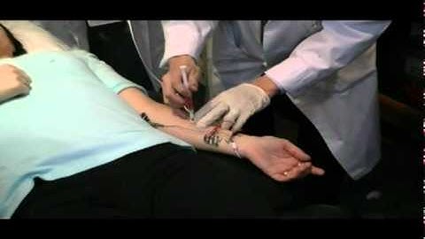 Myoguide Stimulation Location