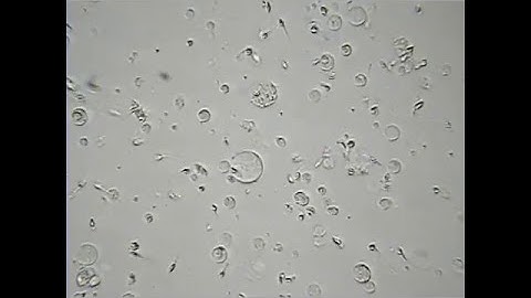 Sperm Motility Scores