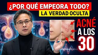 Acné Y Arrugas A La Vez La Paradoja Que Nadie Te Explicó Jamás