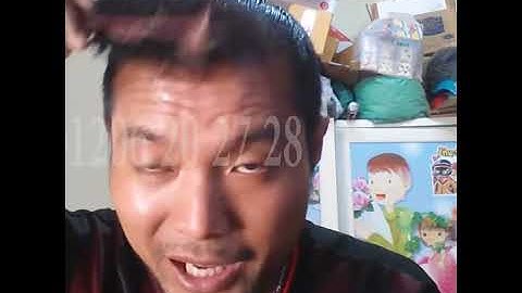 Với 1 liệu trình‼️ TRONG 3 TUẦN⁉️ Khỏi ngay rụng tóc , hói đầu, kích thích mọc tóc