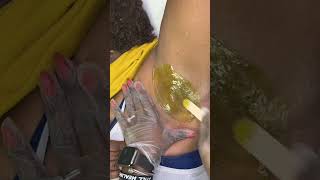 Under Arm #wax using SKYNZ BY R3 ESTHETICS #bodywax #waxing #coldwax #hardwax #bikiniwax #skincare