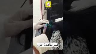 كسربقاعدة قرن ماعز