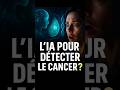 Mammographie et IA : un pari sur la vie ou un risque ?