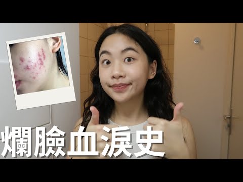 做對這1件事讓我皮膚成功變好！卸妝洗臉方法分享｜心態調整｜