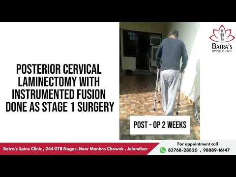 Video thumbnail: Patient testimonial – Dr Sahil Batra