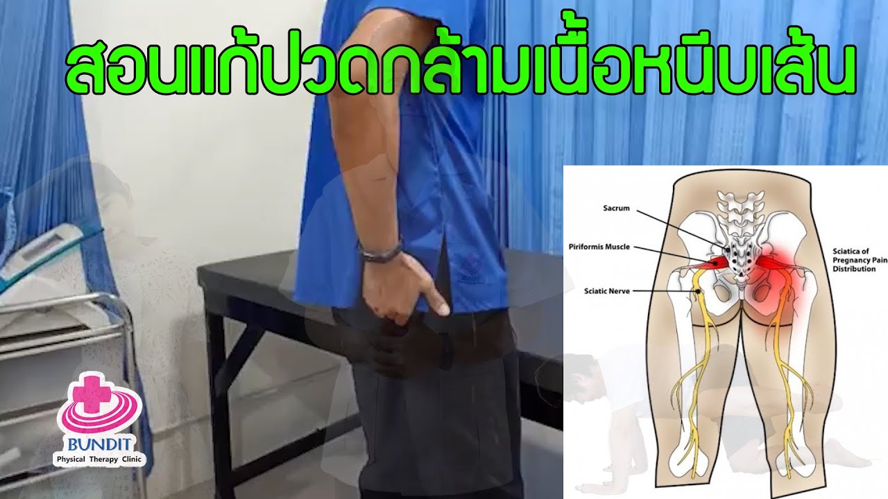 หมอ กายภาพ  Update  สอนแก้ปวดกล้ามเนื้อหนีบเส้นประสาท สลักเพชร ชาลงขา | ตอบคำถามกับบัณฑิต EP.32