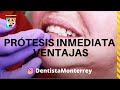 PRÓTESIS INMEDIATA 👅 Después de Extracciónes Multiples NO dejar al Paciente SIN DIENTES