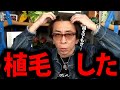 【松浦勝人】植毛した1年後に起きた恐ろしい出来事…【松浦会長 髪の毛 ハゲ 禿げ AGA 治療 ミノキシジル フィナステリド 育毛 脱毛 max松浦 avex 会長 切り抜き】