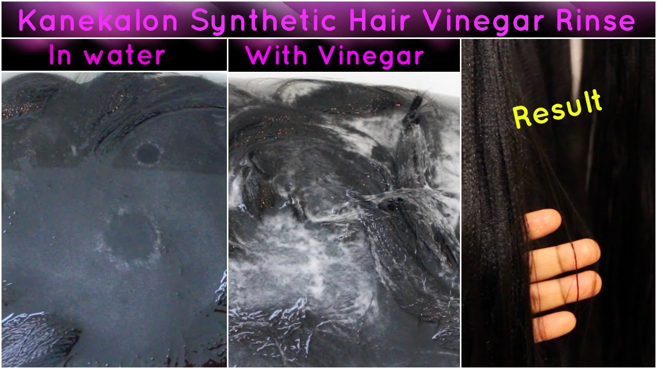 Does vinegar help an itchy scalp?