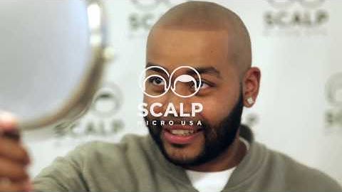 Must See!  Scalp Micropigmentation Testimonial - Scalp Micro USA