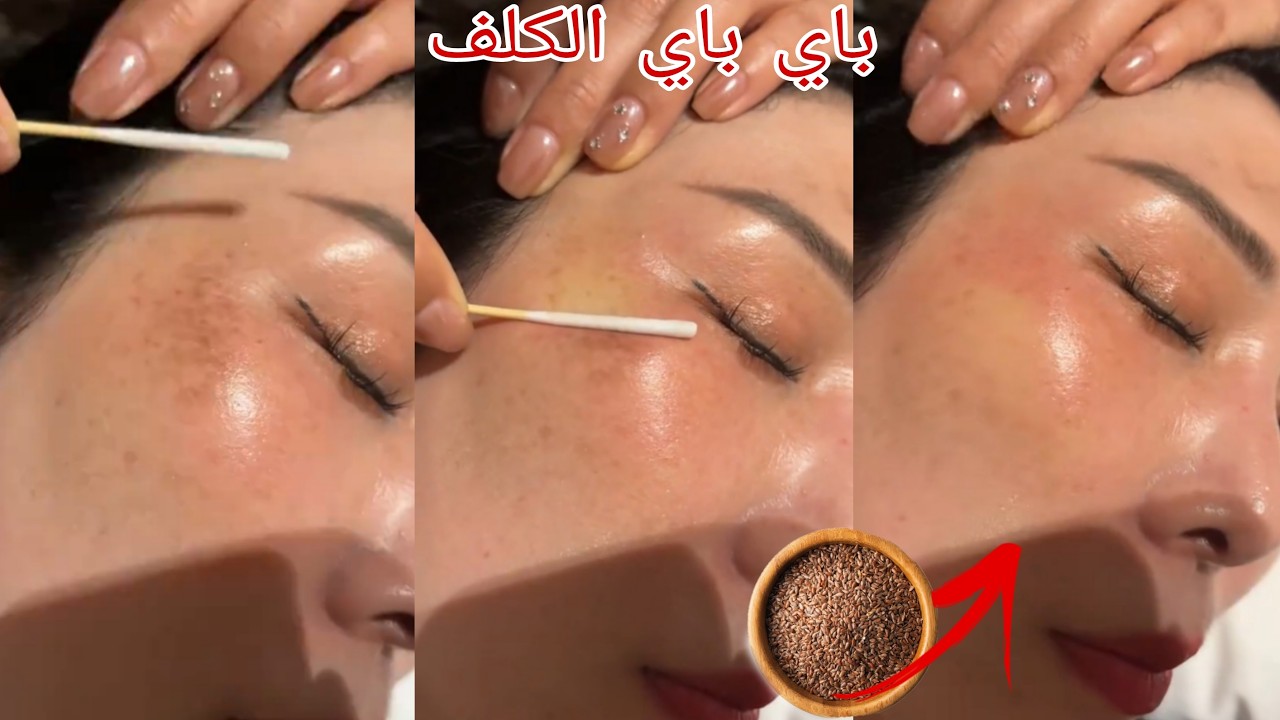 اقوى وصفة في إزالة التجاعيد التصبغات والبقع الداكنة وغادي تبياضي وتزياني هاد الوصفة طووب البنات