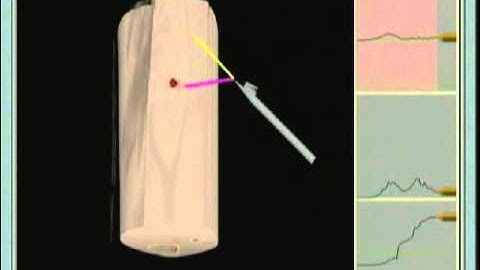 Surgical needle insertion simulation with combined visual and haptic feedback