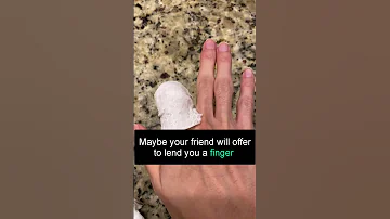 You MUST DO THIS if you cut off your finger - Save your finger while you can!!