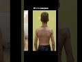 Fixing Scapular Dyskinesis: A Parent’s Guide to Future-Proofing