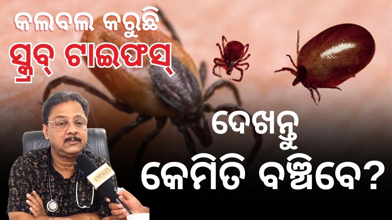 What is scrub typhus? ଆସନ୍ତୁ ଜାଣିବା Dr. Girija Shankar Ugata 