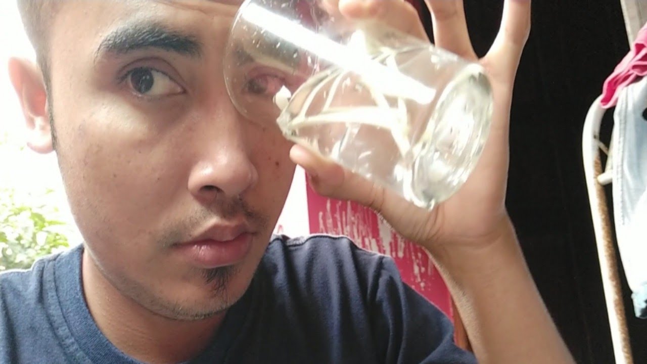 Cara mengobati sakit mata