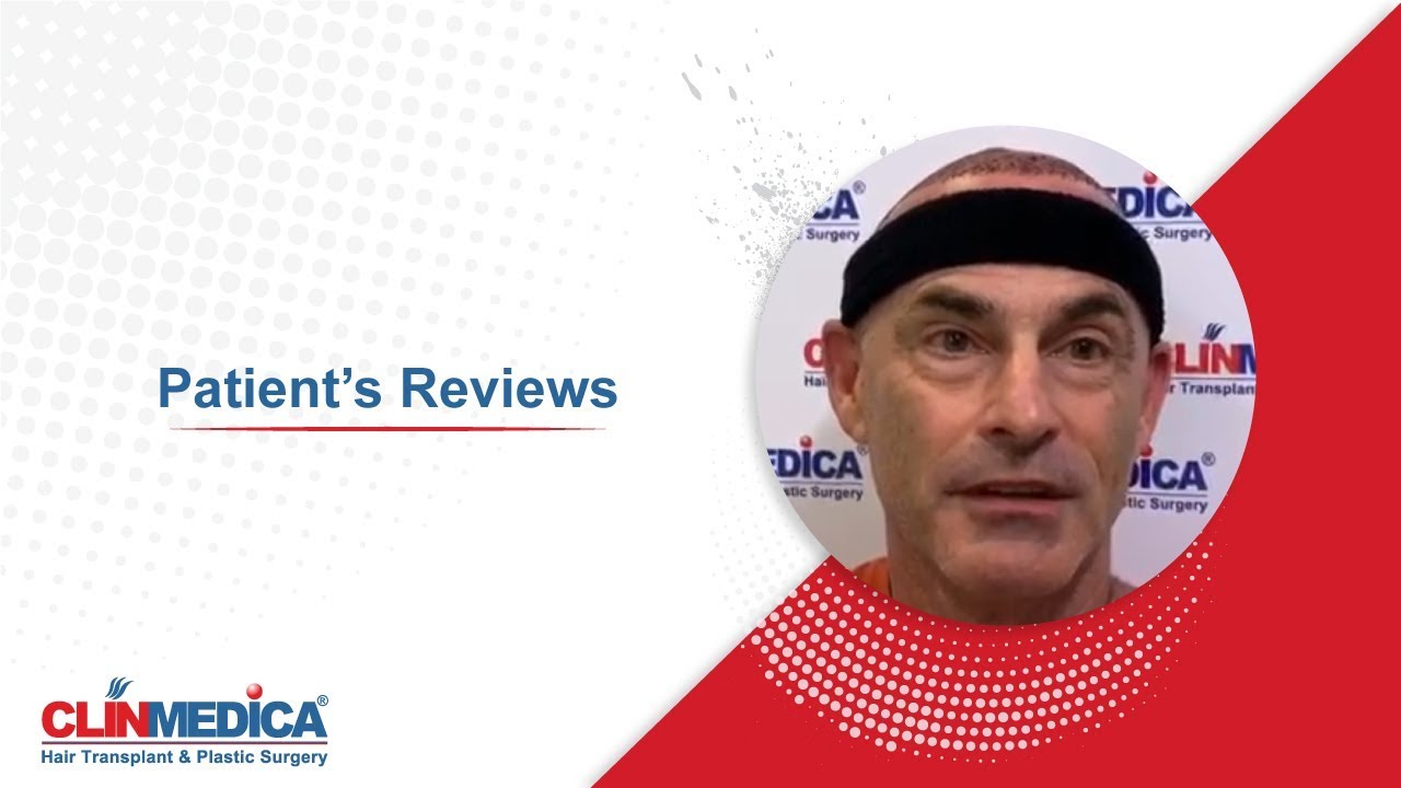 DHI Hair Transplant in Turkey Patient's Reviews - English