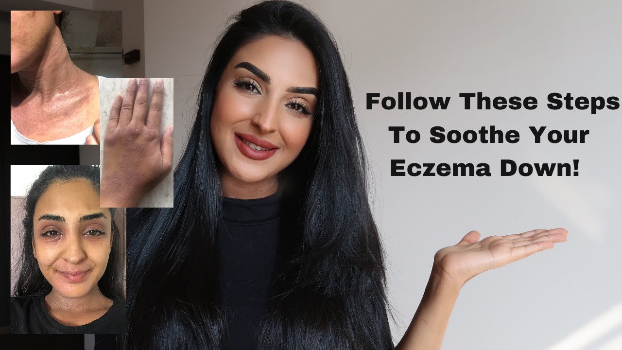 HOW TO SOOTHE YOUR ITCHY ECZEMA DOWN !!! 
