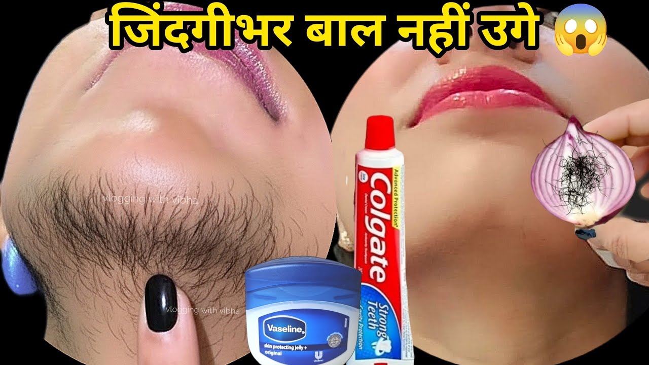 Vaseline से बिना दर्द चेहरे के बाल निकालने का आसान तरीका 😱 Dr. ने बताया | Facial Hair Removal