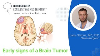 Early signs of a brain tumor (How can brain tumor manifest at early stages).