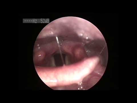 Βίντεο: Μυκητιασική λοίμωξη (Ringworm) στα κουνάβια